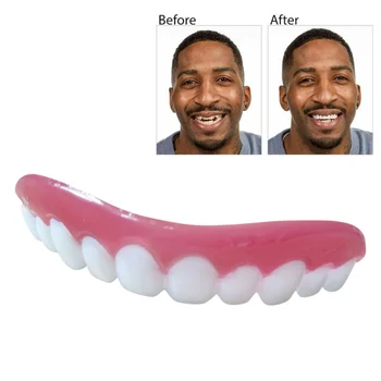 Nové Dokonalý Úsmev Dyhy Na Sklade Oprava Zubov False Protézy Zlé Zuby Dyhy, Bielenie Zubov